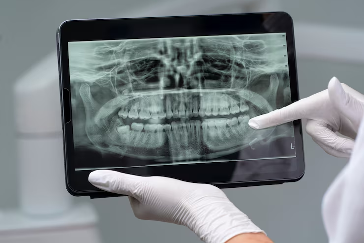 radiologia dentaria